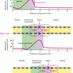 conduction-of-an-action-potential-along-an-axon